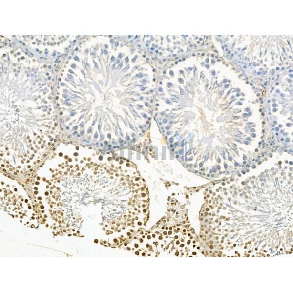 KDM4B / JMJD2B Antibody - DF13288 at 1/100 staining Rat testis tissue by IHC-P.