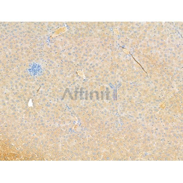 Rab4 Antibody - DF13290 at 1/100 staining Mouse liver tissue by IHC-P.