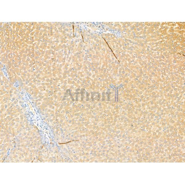 Rab4 Antibody - DF13290 at 1/100 staining Rat liver tissue by IHC-P.
