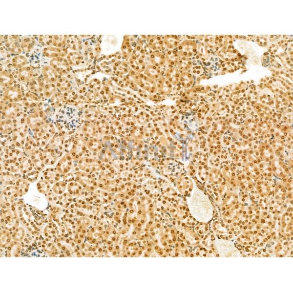 SCXA Antibody - DF13293 at 1/100 staining Mouse kidney tissue by IHC-P.