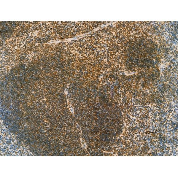 SCXA Antibody - DF13293 at 1/100 staining Mouse spleen tissue by IHC-P.