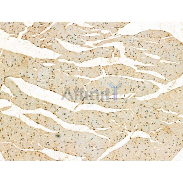 SCXA Antibody - DF13293 at 1/100 staining Mouse heart tissue by IHC-P.