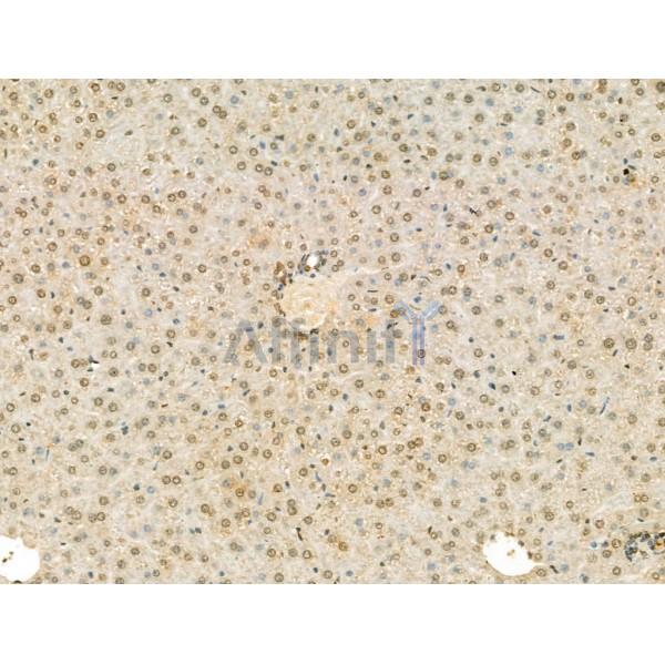 SCXA Antibody - DF13293 at 1/100 staining Mouse liver tissue by IHC-P.