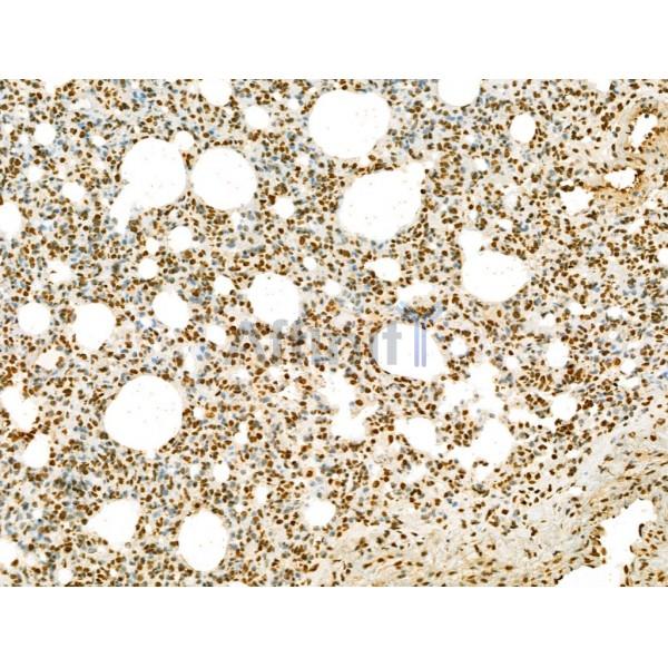 SCXA Antibody - DF13293 at 1/100 staining Rat lung tissue by IHC-P.