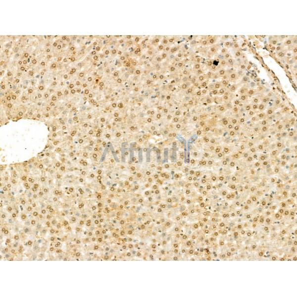 SCXA Antibody - DF13293 at 1/100 staining Rat liver tissue by IHC-P.