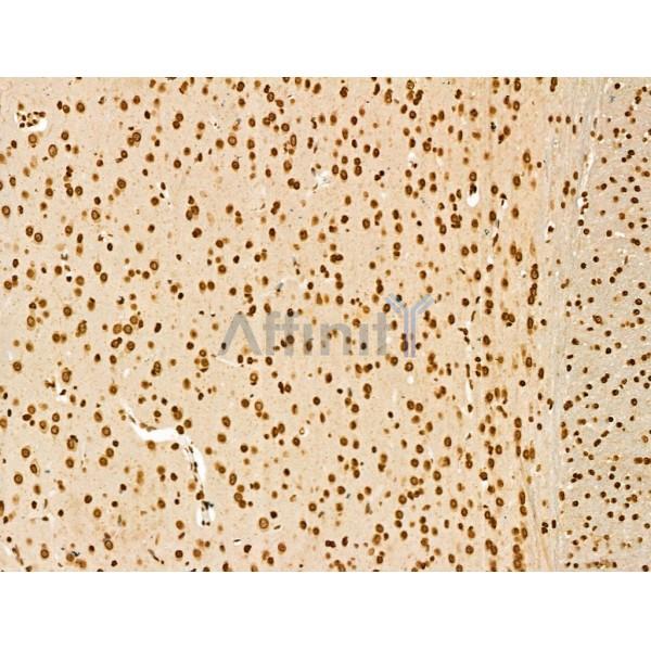SCXA Antibody - DF13293 at 1/100 staining Rat brain tissue by IHC-P.