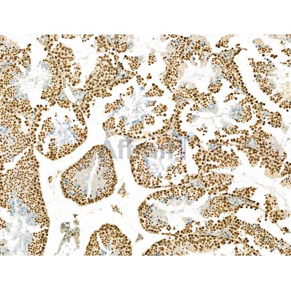 SCXA Antibody - DF13293 at 1/100 staining Mouse testis tissue by IHC-P.