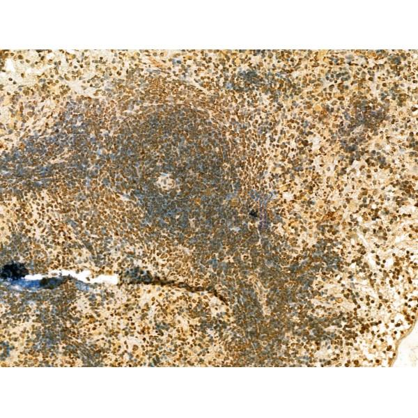 SCXA Antibody - DF13293 at 1/100 staining Rat spleen tissue by IHC-P.