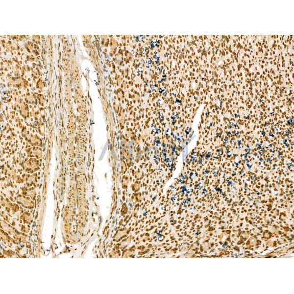SCXA Antibody - DF13293 at 1/100 staining Rat stomach tissue by IHC-P.