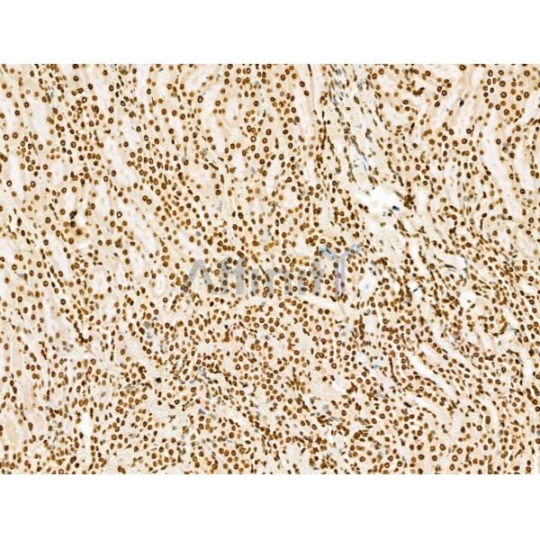 SCXA Antibody - DF13293 at 1/100 staining Rat kidney tissue by IHC-P.