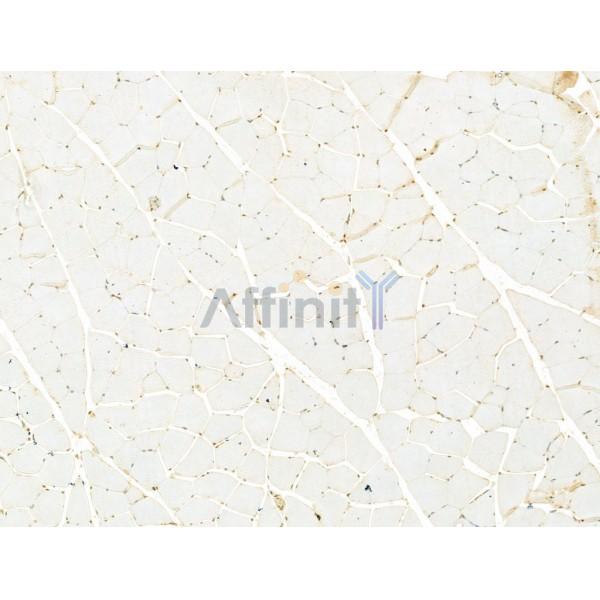 SCXA Antibody - DF13293 at 1/100 staining Rat muscle tissue by IHC-P.