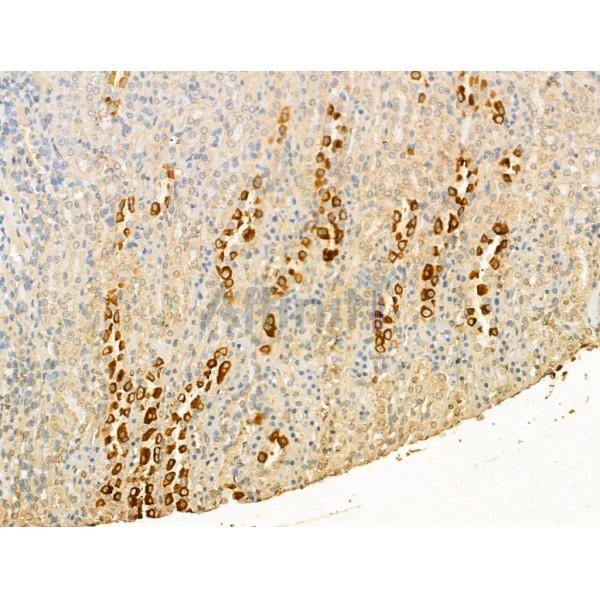 CD62P Antibody - DF13294 at 1/100 staining Rat kidney tissue by IHC-P.