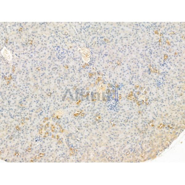 CD62P Antibody - DF13294 at 1/100 staining Mouse kidney tissue by IHC-P.