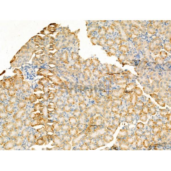 VGLUT2 Antibody - DF13296 at 1/100 staining Mouse kidney tissue by IHC-P.