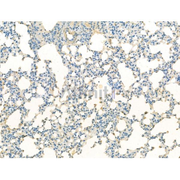VGLUT2 Antibody - DF13296 at 1/100 staining Mouse lung tissue by IHC-P.