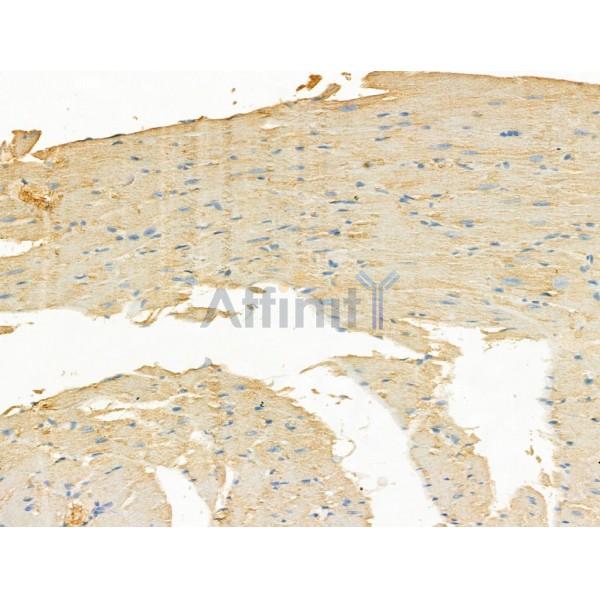 Smoothelin Antibody - DF13304 at 1/100 staining Mouse heart tissue by IHC-P.