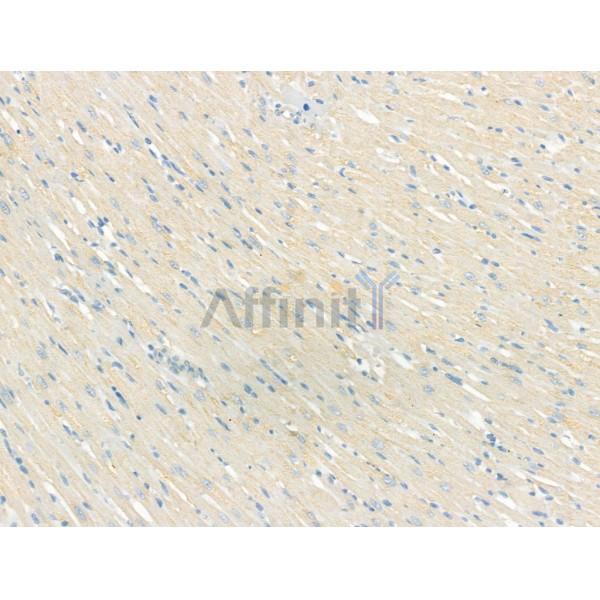 Smoothelin Antibody - DF13304 at 1/100 staining Rat heart tissue by IHC-P.