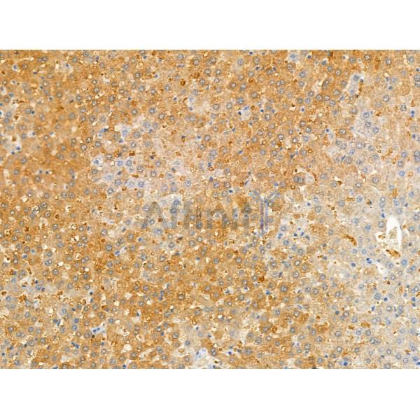 Kallikrein 9 Antibody - DF13306 at 1/100 staining Rat liver tissue by IHC-P.
