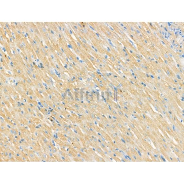 CNGA2 Antibody - DF13311 at 1/100 staining Rat heart tissue by IHC-P.