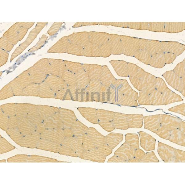 CNGA2 Antibody - DF13311 at 1/100 staining Mouse muscle tissue by IHC-P.