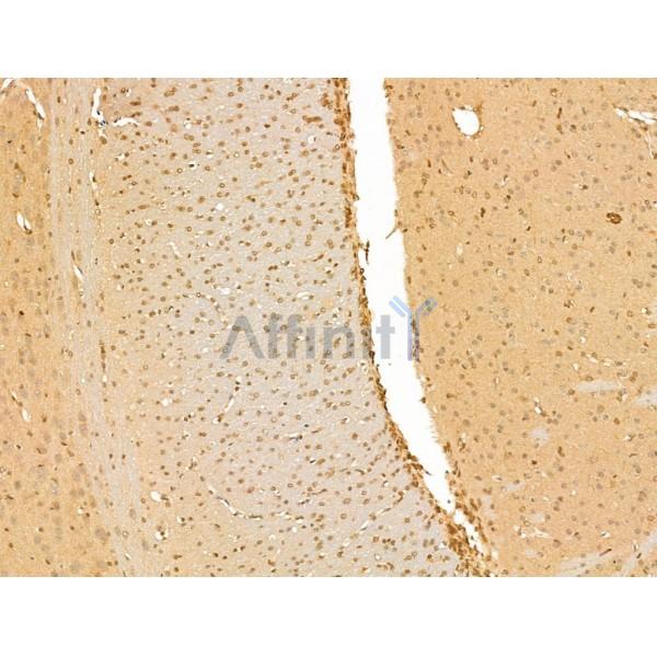 SMC2 Antibody - DF13315 at 1/100 staining Rat brain tissue by IHC-P.