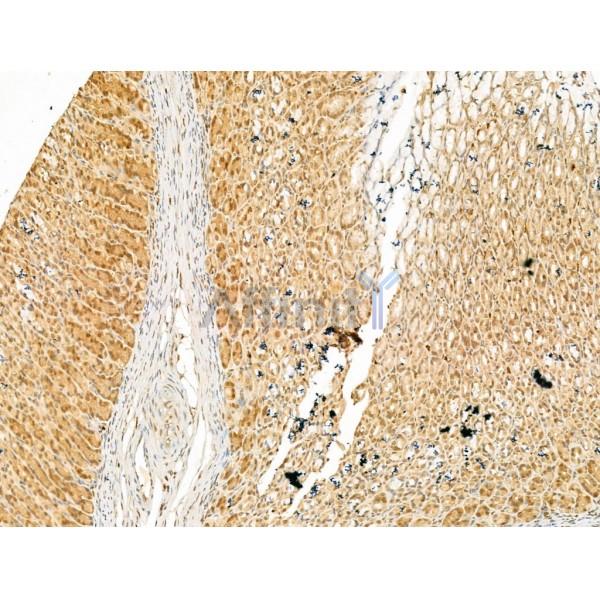SMC2 Antibody - DF13315 at 1/100 staining Rat stomach tissue by IHC-P.