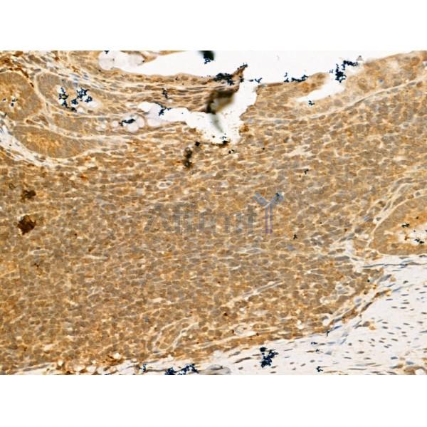SMC2 Antibody - DF13315 at 1/100 staining Rat colorectal tissue by IHC-P.