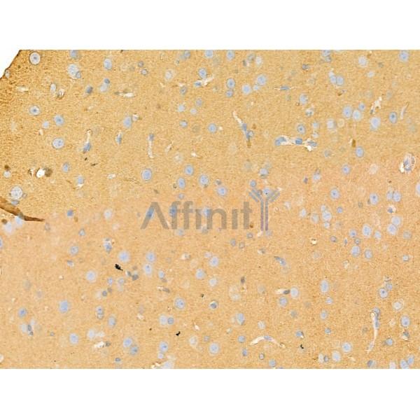 Syntaxin 2 Antibody - DF13316 at 1/100 staining Rat brain tissue by IHC-P.