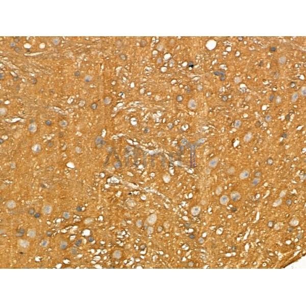Lingo1 Antibody - DF13318 at 1/100 staining Mouse brain tissue by IHC-P.