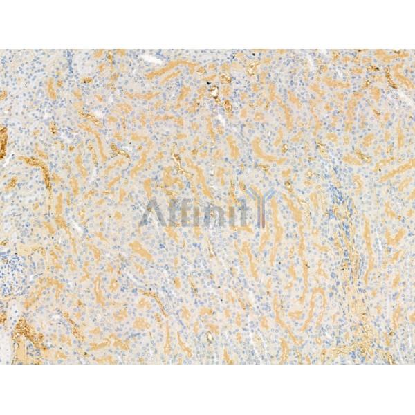 DPP9 - Catalytic domain Antibody - DF13332 at 1/100 staining Rat kidney tissue by IHC-P.