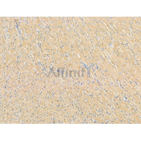 DPP9 - Catalytic domain Antibody - DF13332 at 1/100 staining Rat heart tissue by IHC-P.