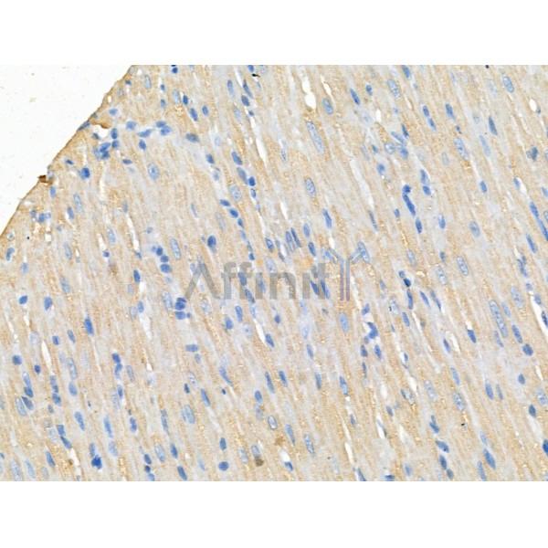 ERp29 Antibody - DF13338 at 1/100 staining Rat heart tissue by IHC-P.
