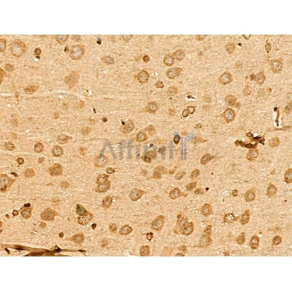 Apelin Antibody - DF13350 at 1/100 staining Rat brain tissue by IHC-P.
