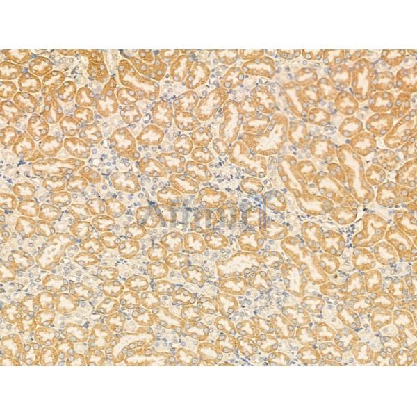 KCNC3 Antibody - DF13352 at 1/100 staining Mouse kidney tissue by IHC-P.