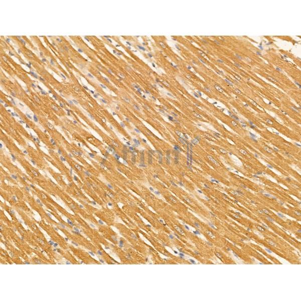 KCNC3 Antibody - DF13352 at 1/100 staining Rat heart tissue by IHC-P.