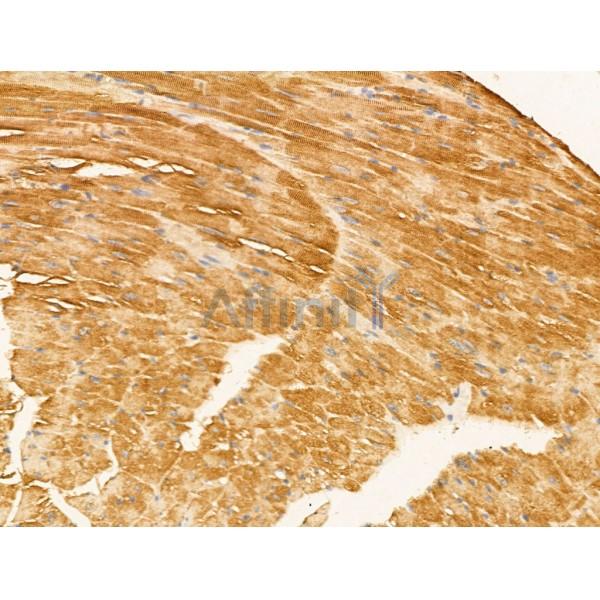 KCNC3 Antibody - DF13352 at 1/100 staining Mouse heart tissue by IHC-P.