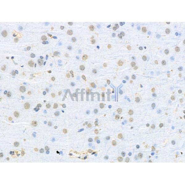 RBM3 Antibody - DF13353 at 1/100 staining Rat brain tissue by IHC-P.