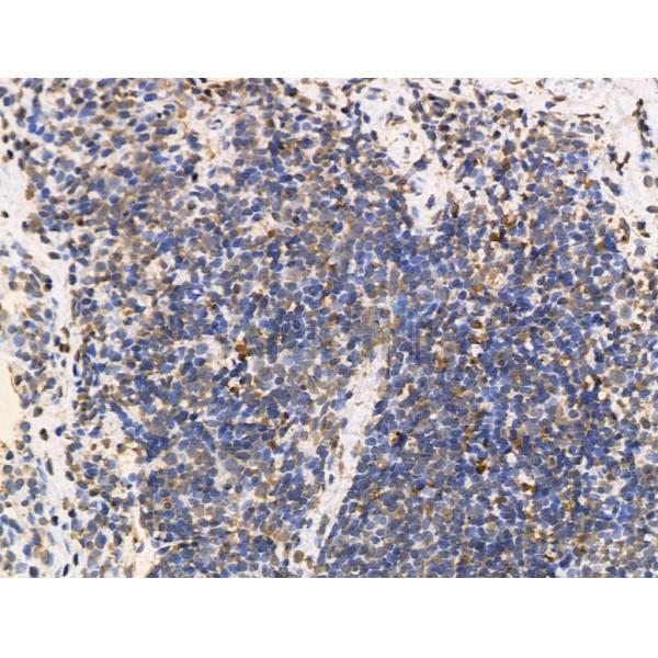 RBM3 Antibody - DF13353 at 1/100 staining Rat lung tissue by IHC-P.