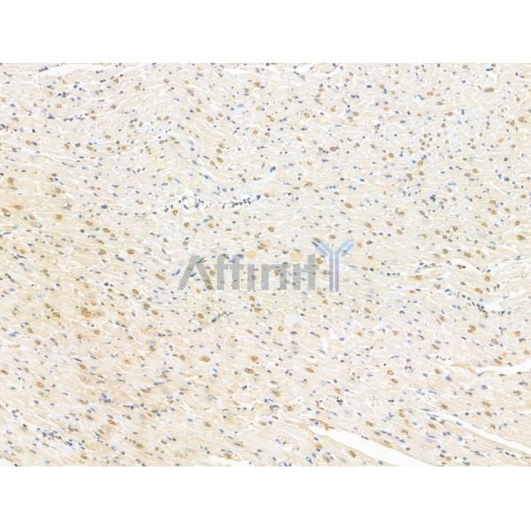 RBM3 Antibody - DF13353 at 1/100 staining Rat heart tissue by IHC-P.