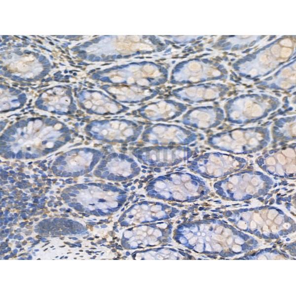 RBM3 Antibody - DF13353 at 1/100 staining Rat colorectal tissue by IHC-P.