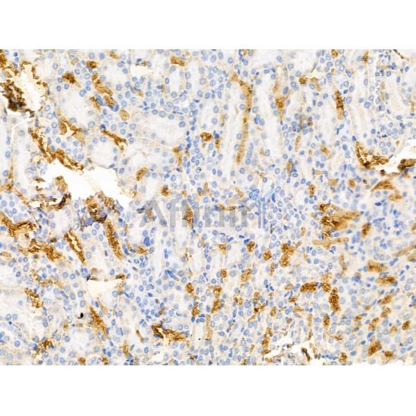 MSH4 Antibody - DF13354 at 1/100 staining Rat lung tissue by IHC-P.