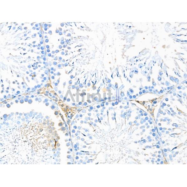 DNase II Antibody - DF13359 at 1/100 staining Rat testis tissue by IHC-P.