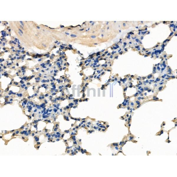 SMCHD1 Antibody - DF13365 at 1/100 staining Mouse lung tissue by IHC-P.