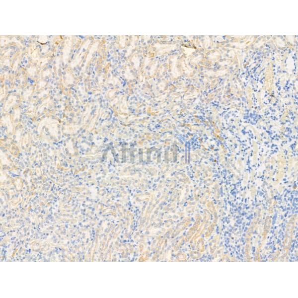 Activin Receptor Type IA Antibody - DF13370 at 1/100 staining Rat kidney tissue by IHC-P.