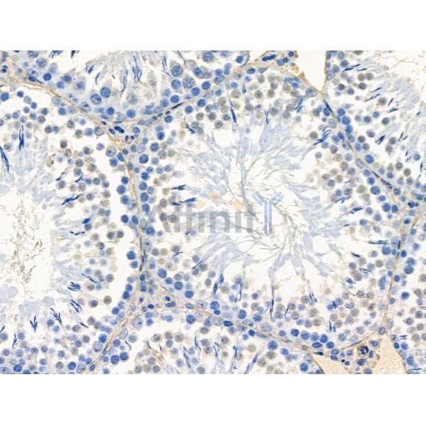 Spt6 Antibody - DF13376 at 1/100 staining Rat testis tissue by IHC-P.