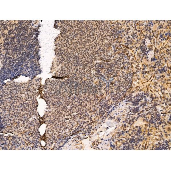 Spt6 Antibody - DF13376 at 1/100 staining Rat spleen tissue by IHC-P.