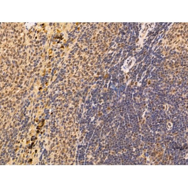 SEPT4 Antibody - DF13393 at 1/100 staining Rat spleen tissue by IHC-P.