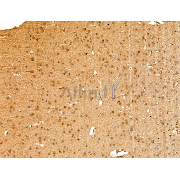 BCL9 Antibody - DF13396 at 1/100 staining Rat brain tissue by IHC-P.