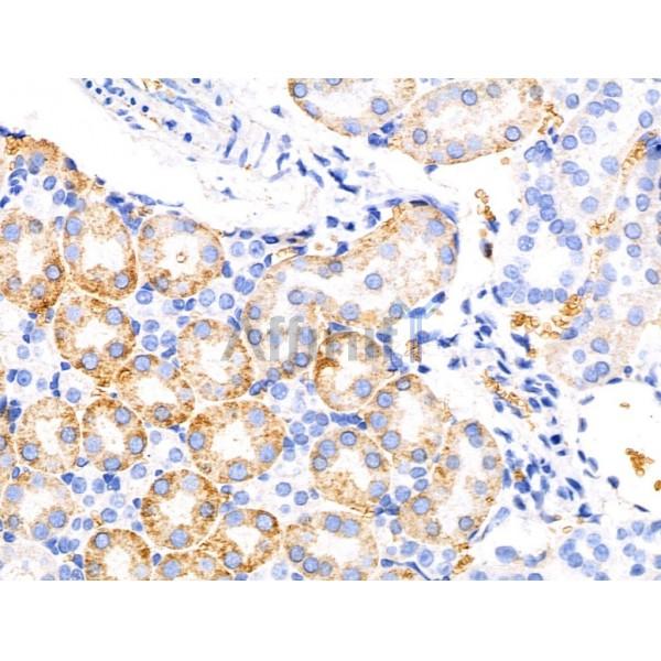 KCNK5 Antibody - DF13412 at 1/100 staining Mouse kidney tissue by IHC-P.