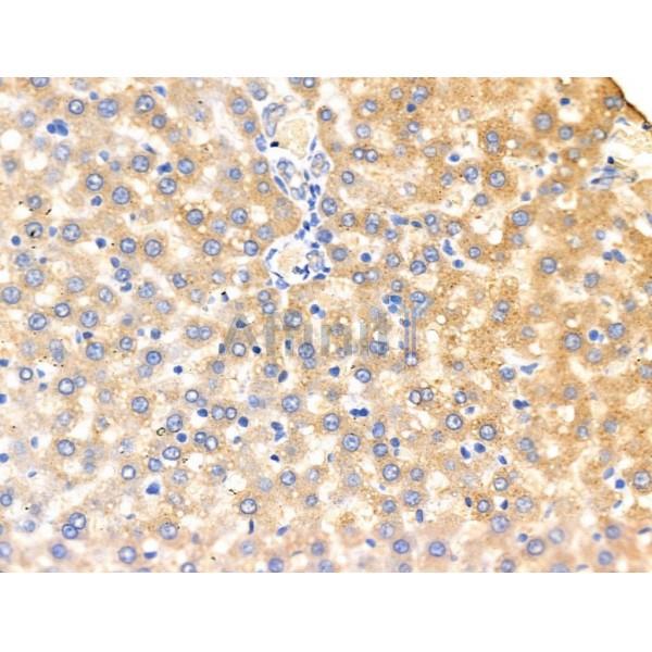 KCNK5 Antibody - DF13412 at 1/100 staining Rat liver tissue by IHC-P.